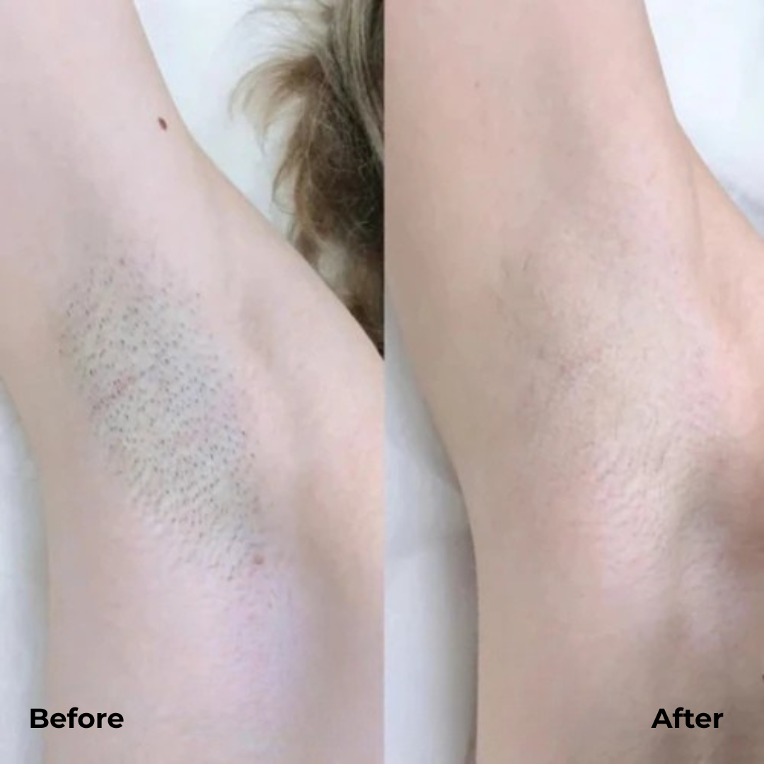 Silktrim™ Afeitadora de Precisión Dual